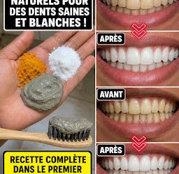 ✨ Brillez en toute confiance : Ayez des dents plus blanches naturellement en seulement 2 minutes !