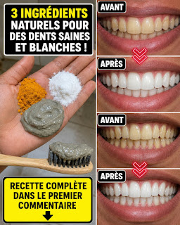✨ Brillez en toute confiance : Ayez des dents plus blanches naturellement en seulement 2 minutes !