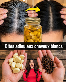 Dites adieu aux cheveux blancs avec l’ail et le clou de girofle : un remède naturel et efficace 🌿✨
