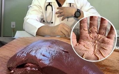 Les médecins révèlent que manger du foie de bœuf peut provoquer…Voir plus
