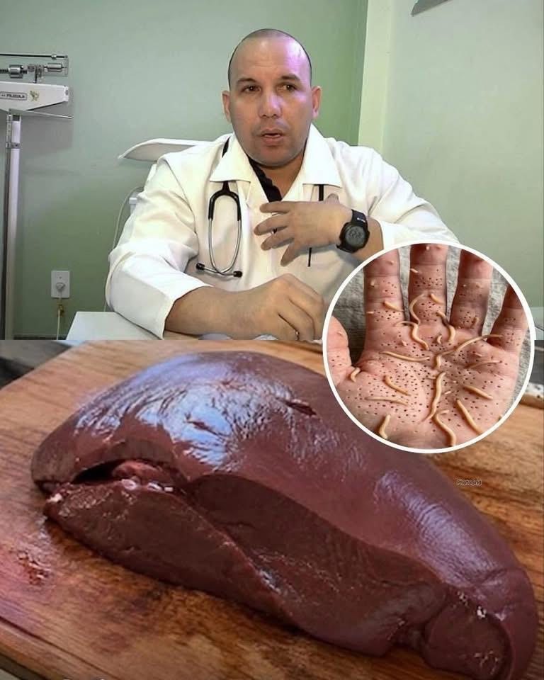 Les médecins révèlent que manger du foie de bœuf peut provoquer…Voir plus