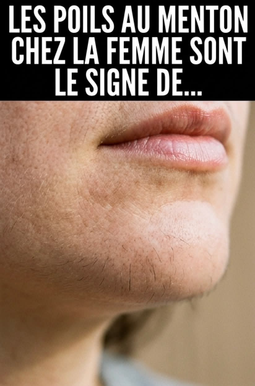 Les poils au menton d’une femme sont un signe de…