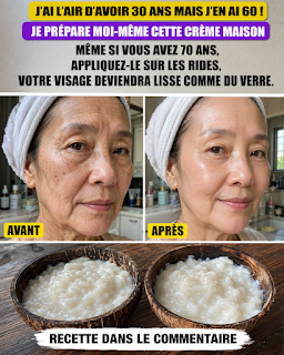 Crème maison au bicarbonate de soude : dites adieu aux rides et aux taches cutanées