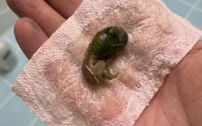 On a trouvé ça dans la salle de bain. Quand je l’ai vu, j’ai eu très peur. Mon mari est