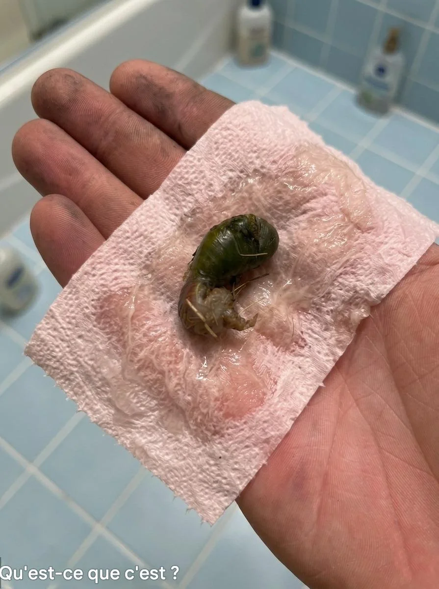 On a trouvé ça dans la salle de bain. Quand je l’ai vu, j’ai eu très peur. Mon mari est