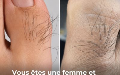 Beaucoup de femmes ignorent ce que les poils sur les orteils révèlent Voi