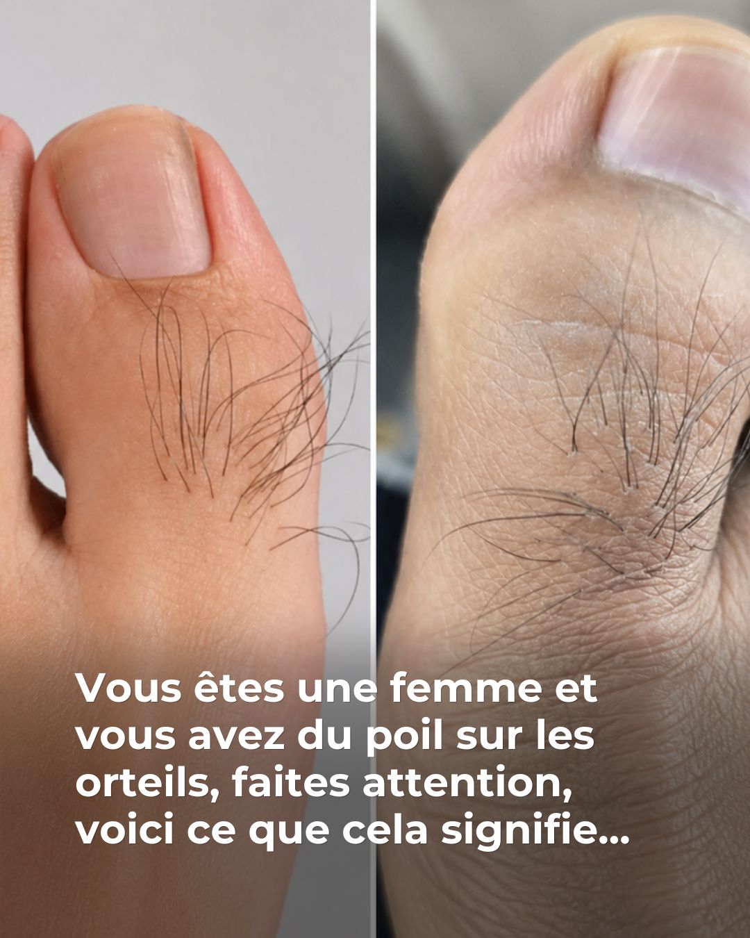 Beaucoup de femmes ignorent ce que les poils sur les orteils révèlent Voi