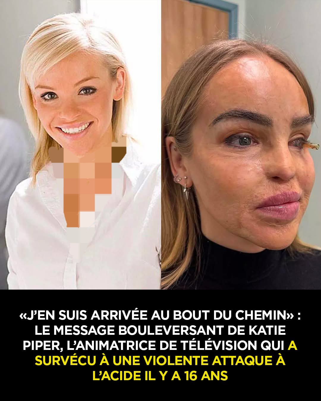 « J’en suis arrivée au bout du chemin » : le message émouvant de Katie Piper, la présentatrice de télévision qui a subi une violente attaque à l’acide il y a 16 ans