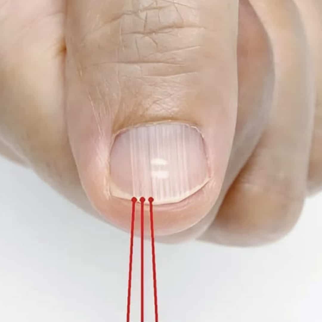 Stries verticales sur les ongles : le message caché de votre corps
