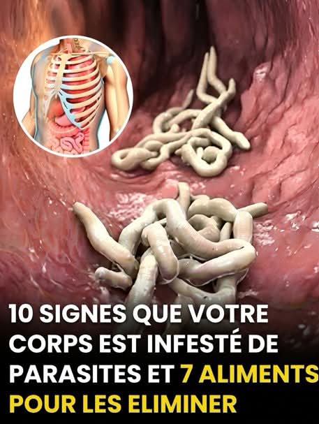 Votre organisme est-il colonisé ? 10 indices à ne pas ignorer pour reprendre le contrôle