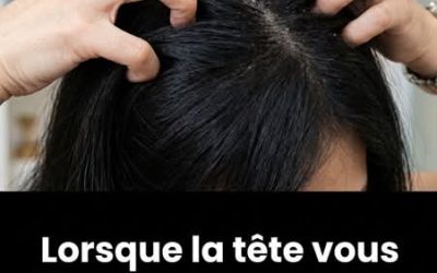 Votre cuir chevelu vous gratte ? On décrypte pour vous les origines du problème