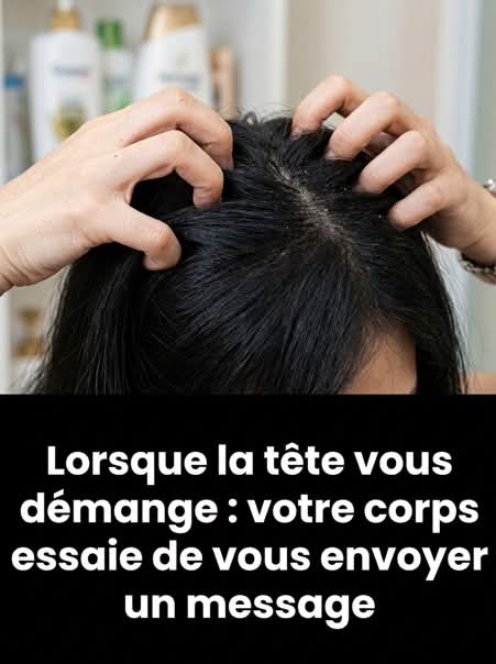 Votre cuir chevelu vous gratte ? On décrypte pour vous les origines du problème