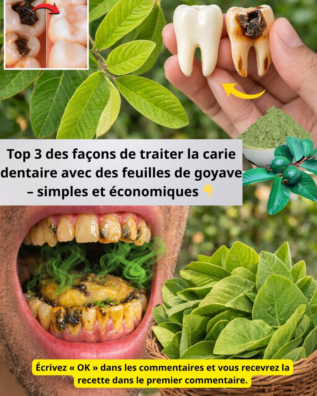 Top 3 façons de traiter la carie dentaire avec des feuilles de goyave – simples et économiques !