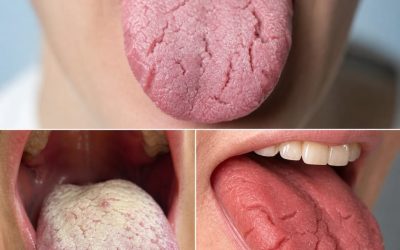 Ce sont les conséquences de dormir avec le the Voir plus