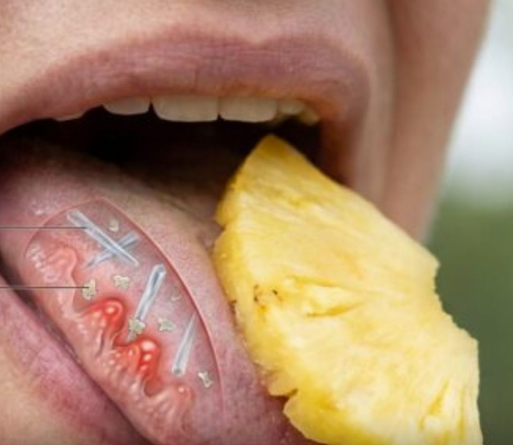 Manger de l’Ananas : Ce Qu’il Faut Vraiment Savoir sur ses Effets, ses Bienfaits