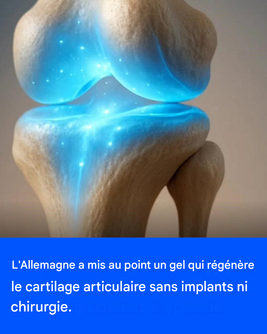 L’Allemagne a mis au point un gel qui régénère le cartilage articulaire sans