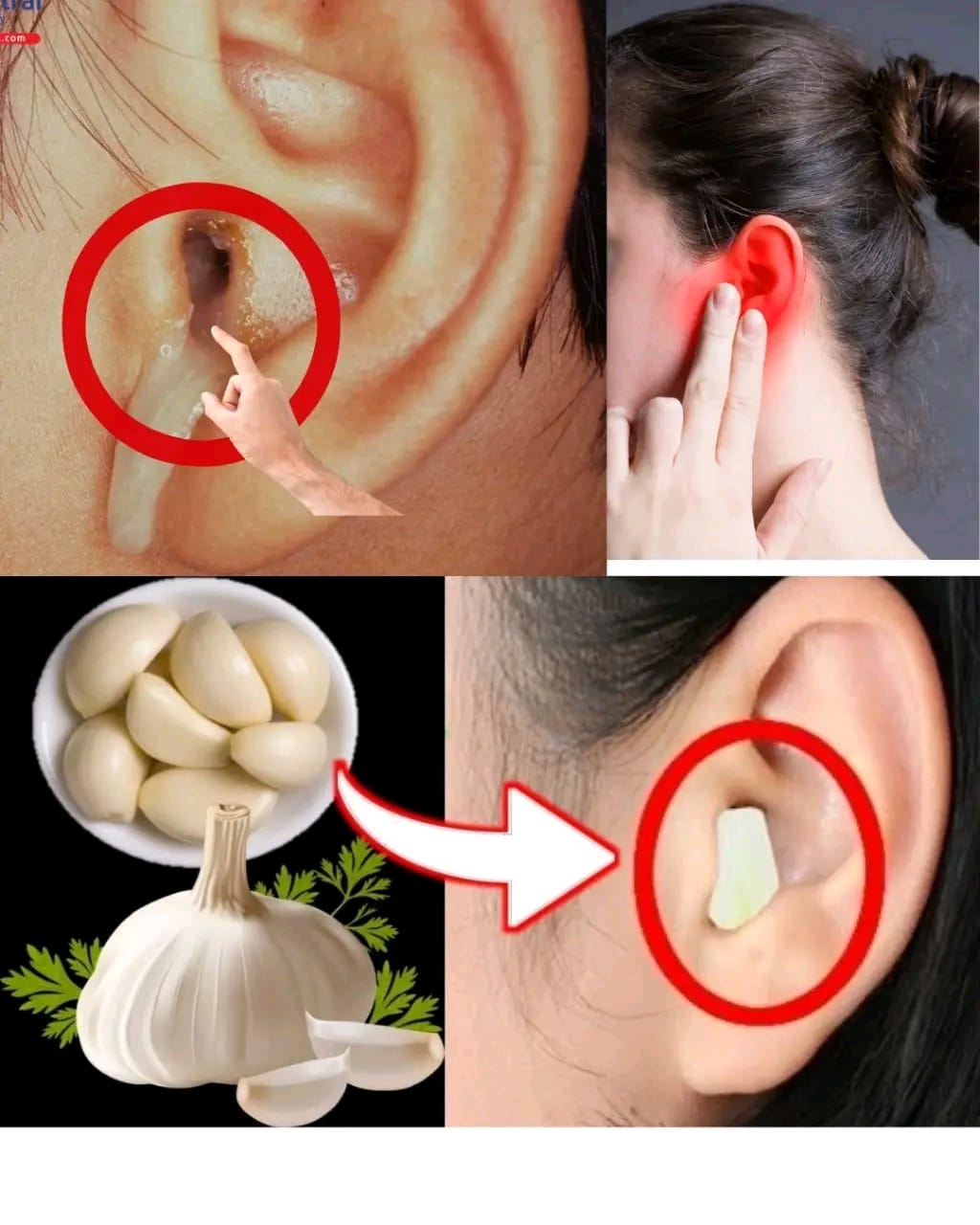L’ail pour la santé des oreilles : soulagement et protection naturels