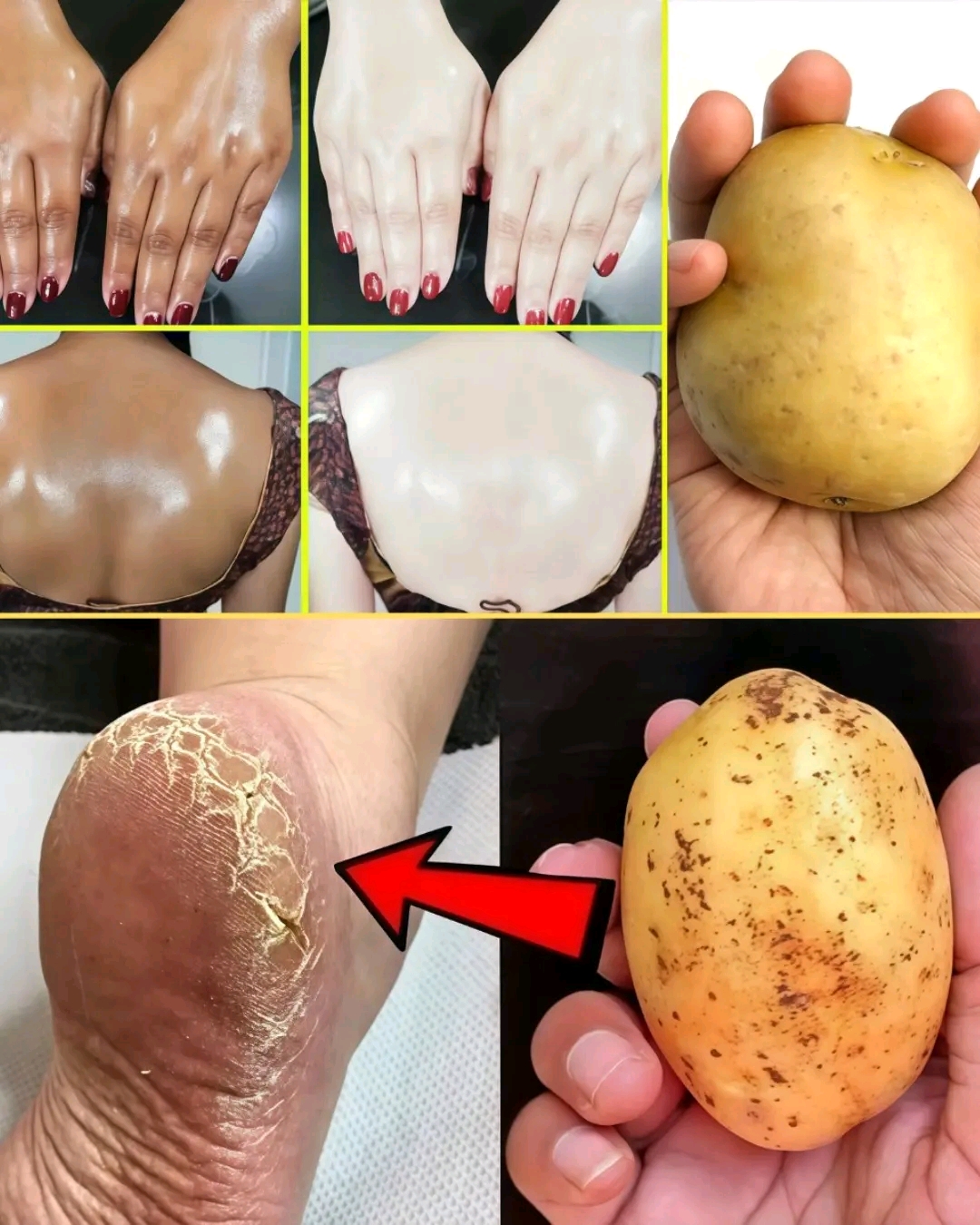 13 utilisations incroyables des pommes de terre pour les cheveux, la peau, les