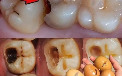En 5 minutes, les dents jaunes deviennent d’un blanc nacré — Le secret