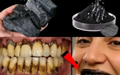 ## Comment soigner une carie naturellement. Suivez ces conseils pour éviter une visite chez le dentiste