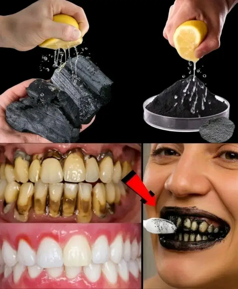 ## Comment soigner une carie naturellement. Suivez ces conseils pour éviter une visite chez le dentiste