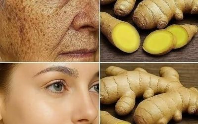 Le gingembre est 100 fois plus efficace que le Botox pour éliminer les rides