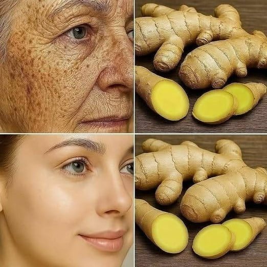 Le gingembre est 100 fois plus efficace que le Botox pour éliminer les rides