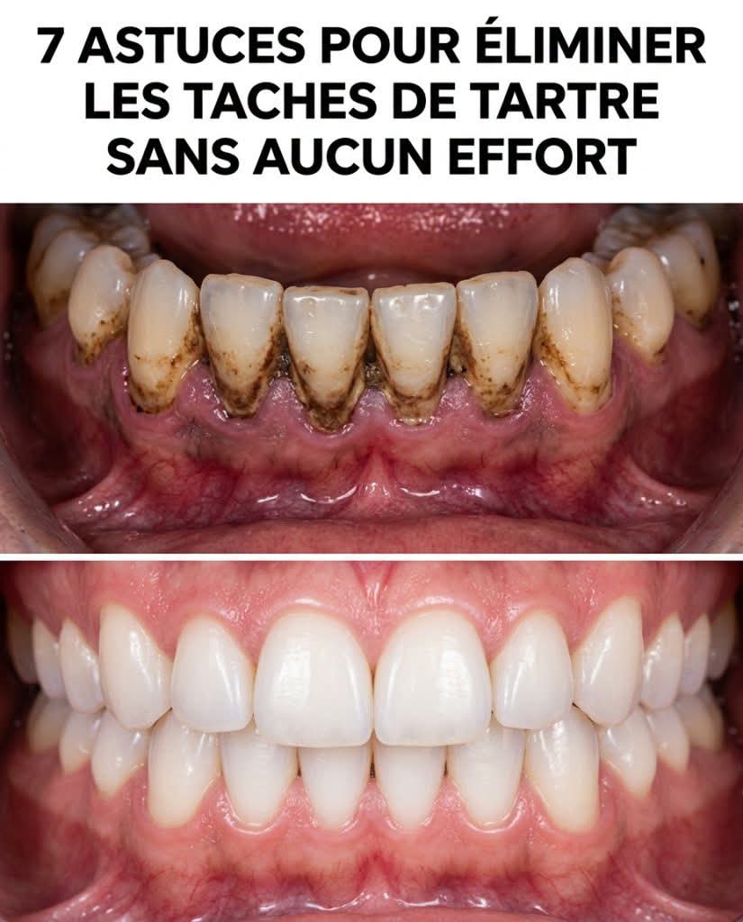 7 méthodes naturelles pour dire adieu aux dépôts de tartre sur les dents