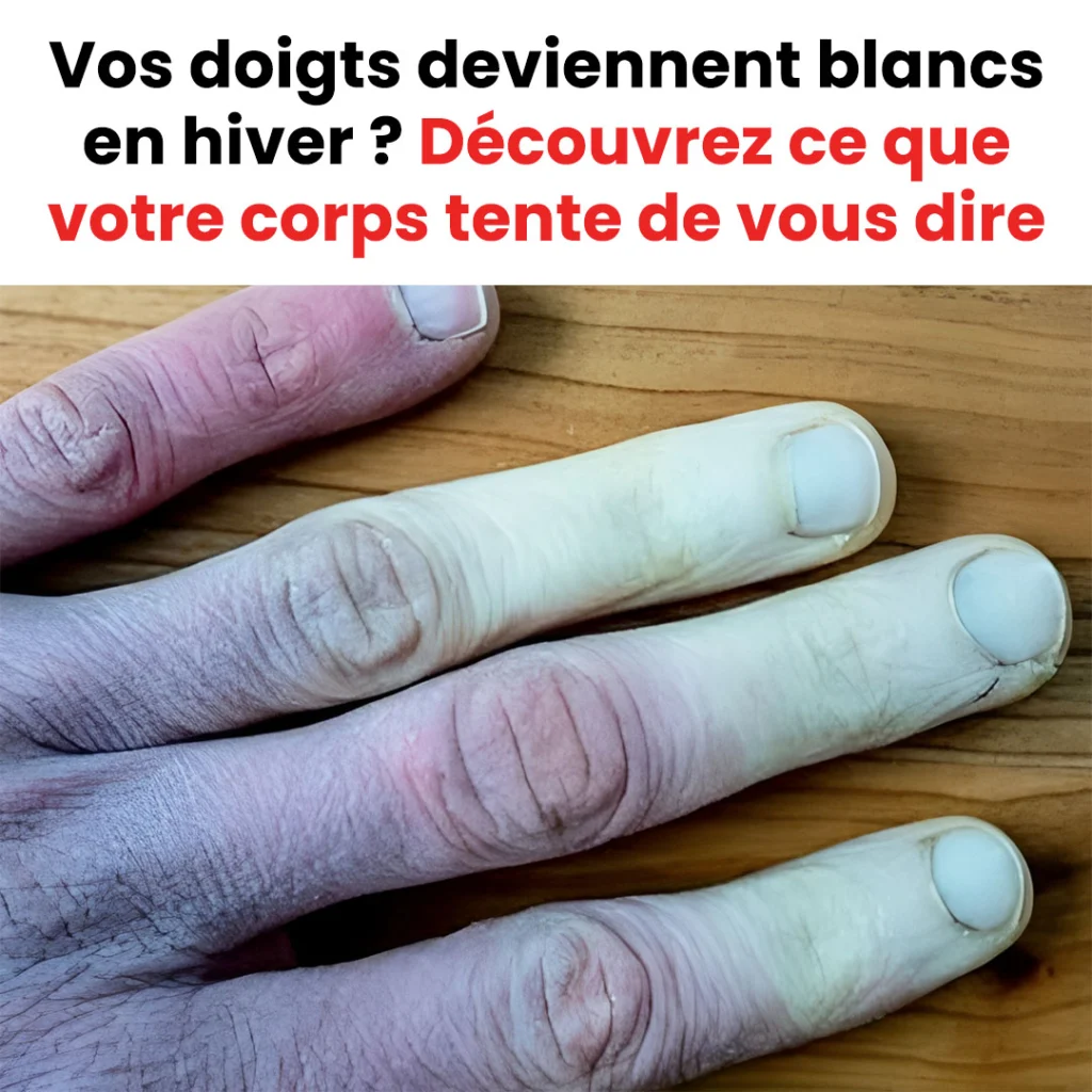 Comment protéger vos mains du froid hivernal ?